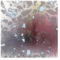 Avulsions- Expanding Program